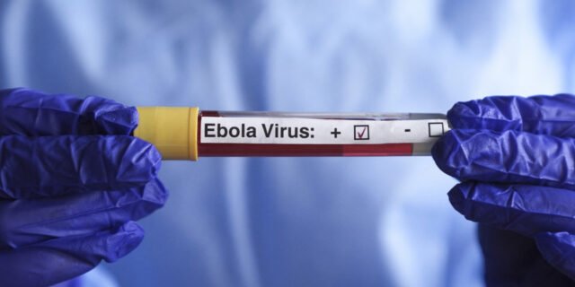 1779716396_ebola_credits_dilara_irem_sancar_anadolu_anadolu_via_afp_6a144940674d4.jpg