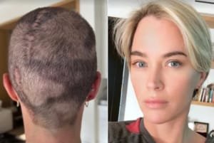 Teddi Mellencamp ផ្តល់បច្ចុប្បន្នភាពជាវិជ្ជមានលើមហារីកខួរក្បាលដំណាក់កាលទី 4