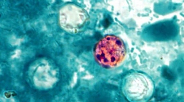 ការ​ប៉ះពាល់​នឹង​ប៉ារ៉ាស៊ីត Cyclospora នាំ​ឱ្យ​កើត​ជំងឺ Cyclosporiasis ដែល​ជា​មេរោគ​ក្នុង​ក្រពះ​ពោះវៀន​ដែល​អាច​ធ្វើ​ឱ្យ​រាគ​ផ្ទុះ