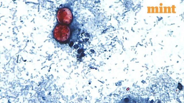 Cyclospora-Outbreak-0_1784038863421_1784038873378_7a8b7d94-fb98-45ee-90a7-d28c38e35570.jpg