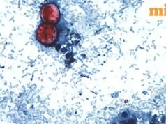 ប៉ារ៉ាស៊ីត Cyclospora កំពុងរីករាលដាលនៅក្នុងរដ្ឋចំនួន 34 របស់សហរដ្ឋអាមេរិក៖ ហេតុអ្វីបានជាករណីកើនឡើង ហើយតើអាហារណាខ្លះកំពុងត្រូវបានស៊ើបអង្កេត?