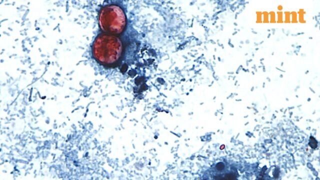 Cyclospora-Outbreak-0_1784128526367_1784128545652_36dad231-d682-4b3d-a642-db812e07e5f7.jpg